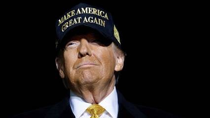 Kronik venöz yetmezlik nedir? Trump'ın rahatsızlığıyla ilgili bilinenler