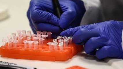 Bakanlıktan M çiçeği virüsü açıklaması: Türkiye'de vaka var mı?