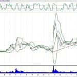 BİST 100 hisselerinin teknik analizi (14.10.2018)-2