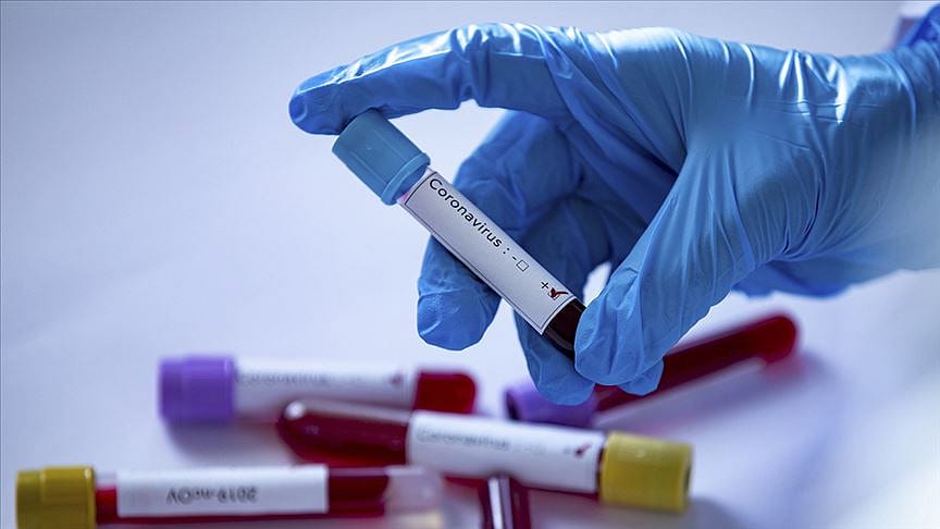 Türkiye’de koronavirüs istatistikleri: Bir kişi nasıl 30 kişiye bulaştırdı?
