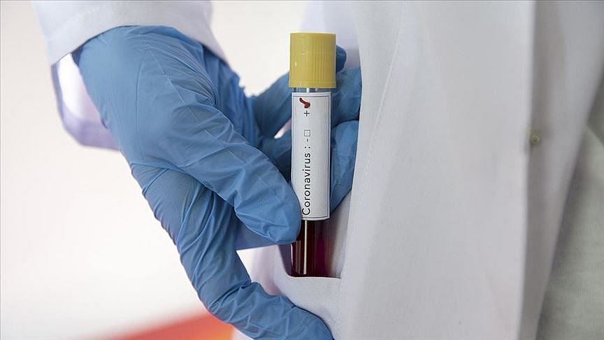 ABD'de 5 dakikada sonuç veren test kiti geliştirildi