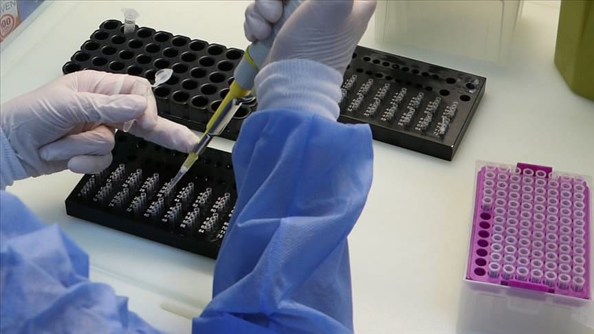 Kovid 19'u 5 dakikada saptayabilen test yöntemi bulundu