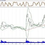 BİST 100 hisselerinin teknik analizi (28.10.2018)-4
