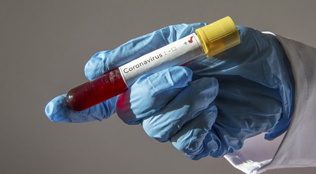 Koronavirüs salgını sürecinde şirketler ne yapmalı?