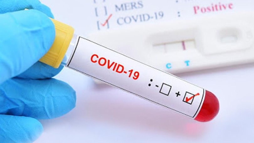 AB'den Kovid-19 aşısı için ön alım hazırlığı