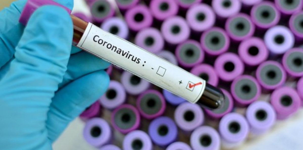 Türkiye koronavirüs tablosu açıklandı