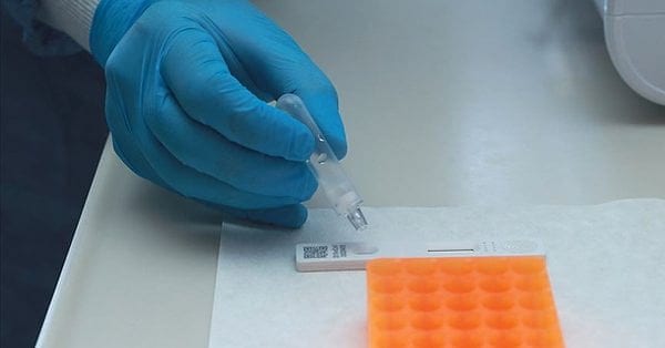 Kovid-19 tarama testinin yerlisini üretti, 21 ülkeye sattı