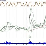 BİST 100 hisselerinin teknik analizi (04.11.2018)-3