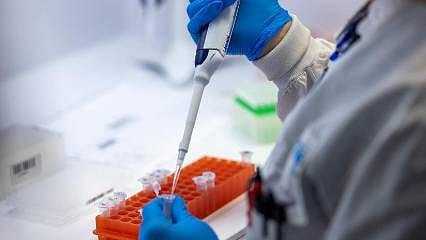 Eris varyantı nedir? Belirtileri ne? Merak edilen sorularla Eris varyantı