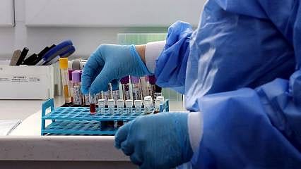 Depremde hayatını kaybeden yakınını arayanlar kan örneği vermeli