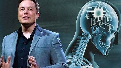 Musk'ın beyin çipi projesine onay çıktı... İnsanlar üzerinde denenecek 